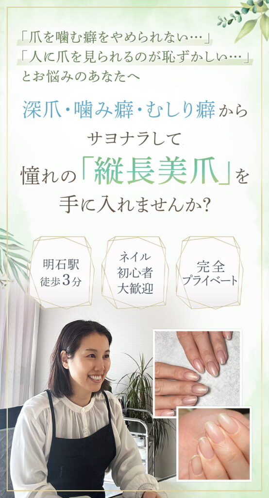 明石市の深爪矯正専門サロン｜深爪・噛み爪・むしり癖でお悩みならトレフル