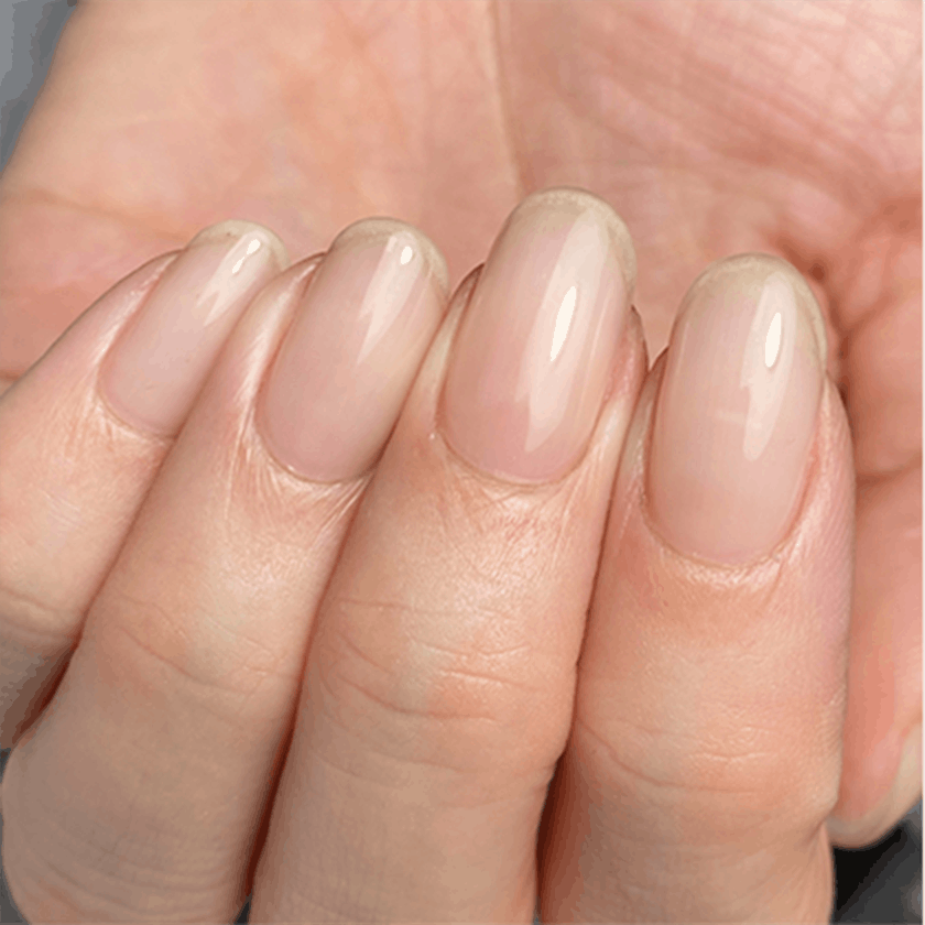 明石市の深爪矯正専門サロン｜深爪・噛み爪・むしり癖でお悩みならトレフル