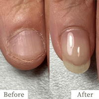 明石市の深爪矯正専門サロン｜深爪・噛み爪・むしり癖でお悩みならトレフル