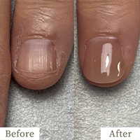 明石市の深爪矯正専門サロン｜深爪・噛み爪・むしり癖でお悩みならトレフル